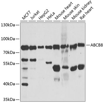 ABCB8 Rabbit polyclonal antibody