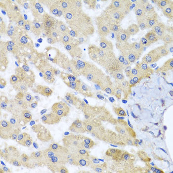 ABCB8 Rabbit polyclonal antibody