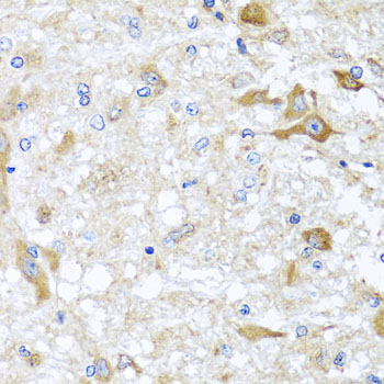 ABCB8 Rabbit polyclonal antibody