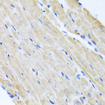 ABCB8 Rabbit polyclonal antibody