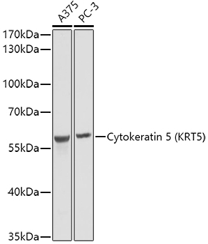 Cytokeratin 5 Rabbit polyclonal antibody