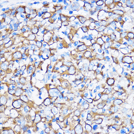 Cytokeratin 5 Rabbit polyclonal antibody