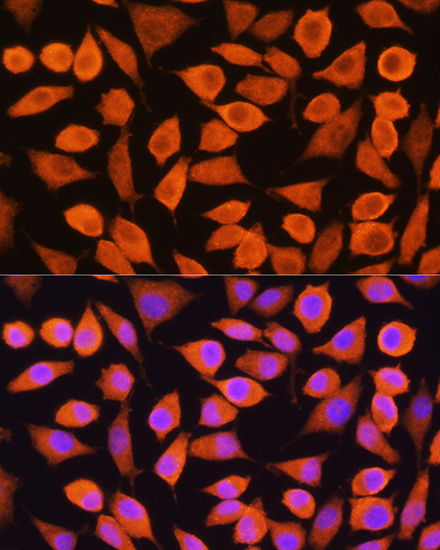 Cytokeratin 5 Rabbit polyclonal antibody
