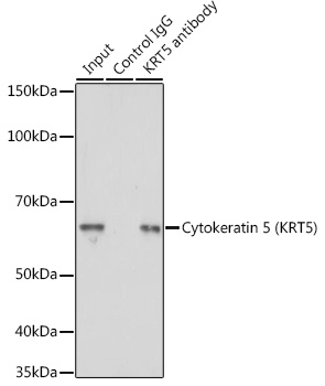 Cytokeratin 5 Rabbit polyclonal antibody