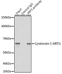 Western blot - Cytokeratin 5 (KRT5) Rabbit pAb (A2662)