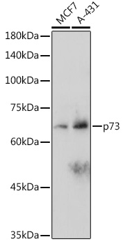 p73 Rabbit monoclonal antibody