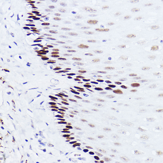 p73 Rabbit monoclonal antibody