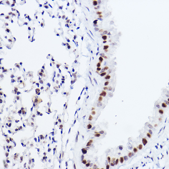 p73 Rabbit monoclonal antibody