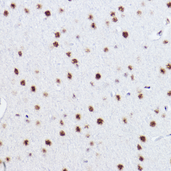 p73 Rabbit monoclonal antibody