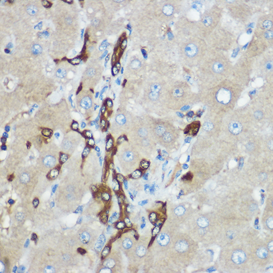 Calpain 2 Rabbit polyclonal antibody