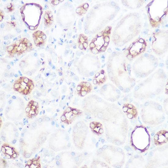 Calpain 2 Rabbit polyclonal antibody