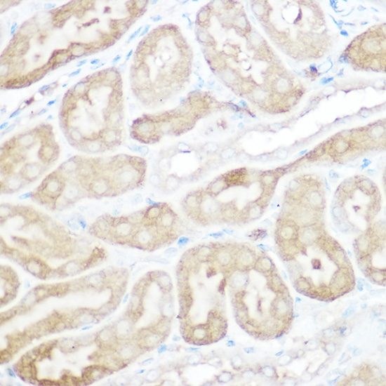 Calpain 2 Rabbit polyclonal antibody
