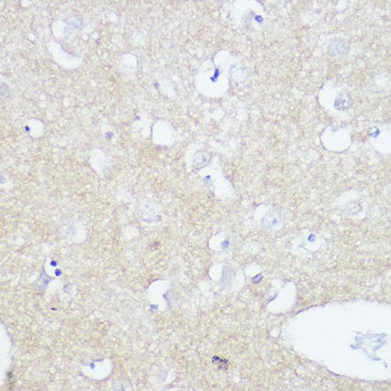 TrkA+B+C Rabbit monoclonal antibody