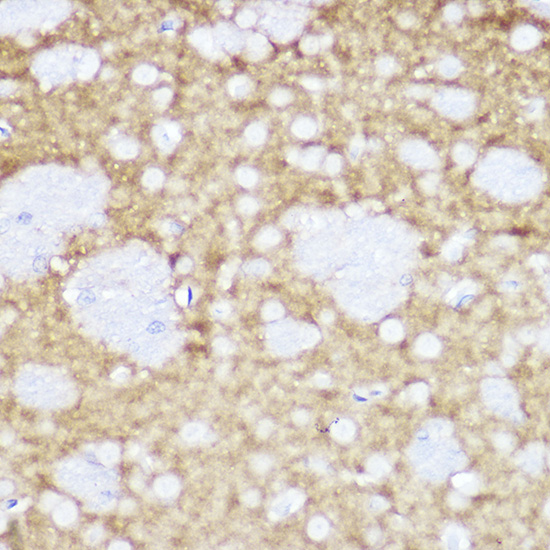 TrkA+B+C Rabbit monoclonal antibody
