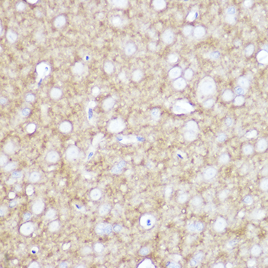 TrkA+B+C Rabbit monoclonal antibody