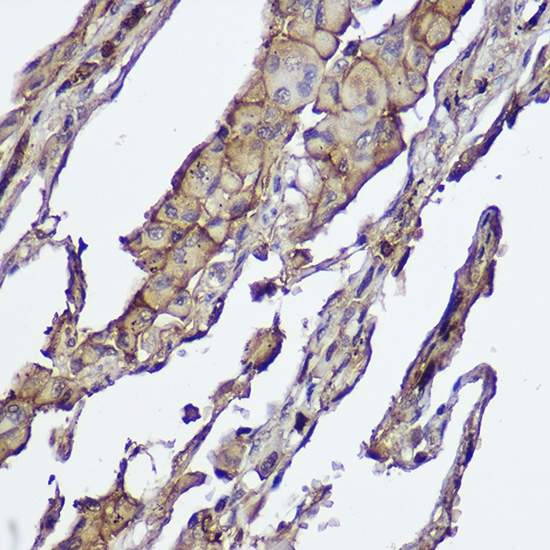 AKT1/2 Rabbit monoclonal antibody