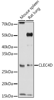 CLEC4D Rabbit polyclonal antibody