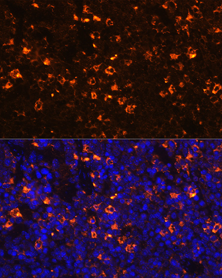 CLEC4D Rabbit polyclonal antibody