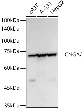 CNGA2 Rabbit polyclonal antibody