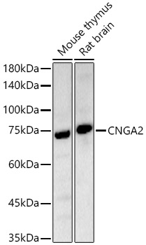 CNGA2 Rabbit polyclonal antibody