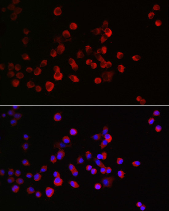CRMP1 Rabbit polyclonal antibody