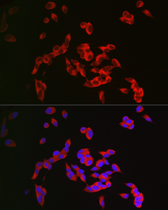 CRMP1 Rabbit polyclonal antibody
