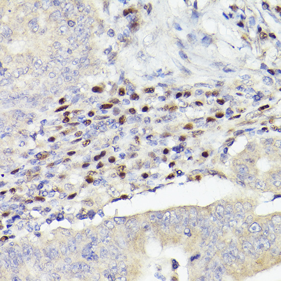 MEF2A+MEF2C Rabbit monoclonal antibody