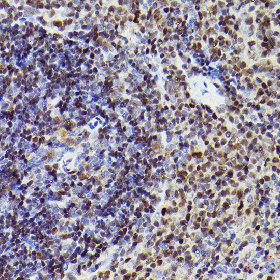 MEF2A+MEF2C Rabbit monoclonal antibody