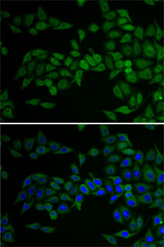 E2F6 Rabbit polyclonal antibody