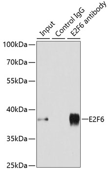 E2F6 Rabbit polyclonal antibody