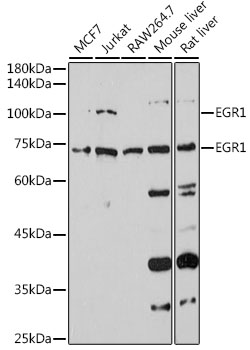 EGR1 Rabbit polyclonal antibody