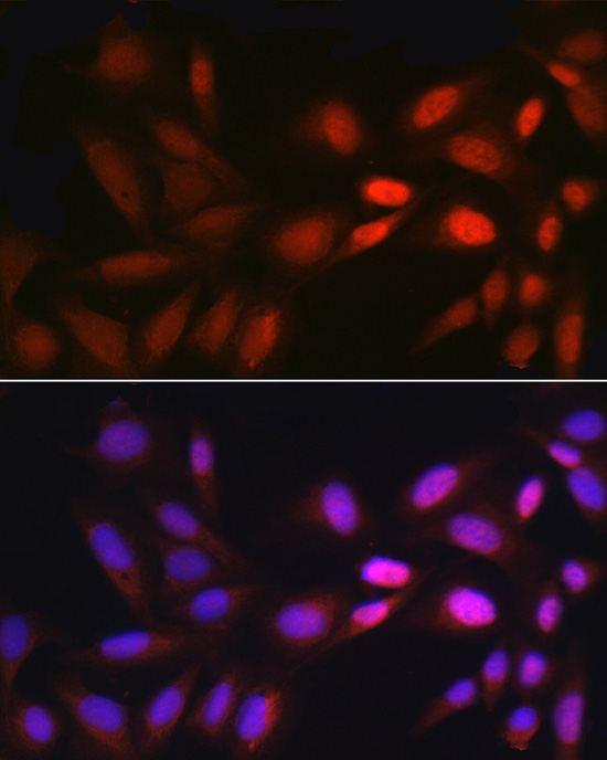 EGR1 Rabbit polyclonal antibody