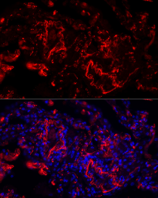 ELN Rabbit polyclonal antibody