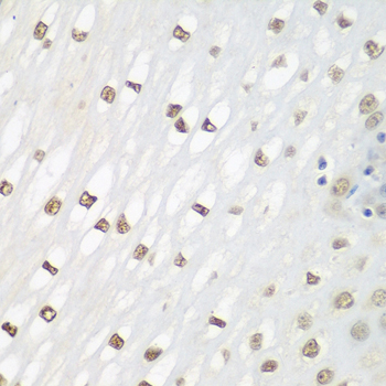 FOSL2 Rabbit polyclonal antibody