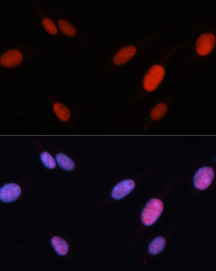FOSL2 Rabbit polyclonal antibody