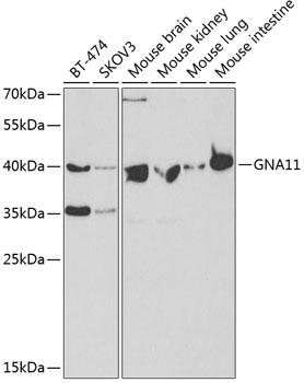 GNA11 Rabbit polyclonal antibody