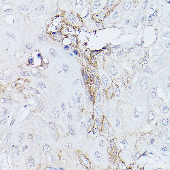 GNA11 Rabbit polyclonal antibody
