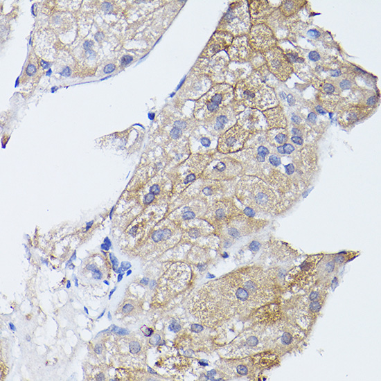 GNA11 Rabbit polyclonal antibody