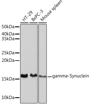 gamma-Synuclein Rabbit mAb