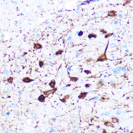 gamma-Synuclein Rabbit monoclonal antibody