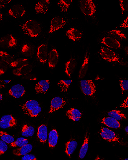 IMMT Rabbit polyclonal antibody