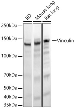 ABclonal:Western blot - Vinculin Rabbit mAb (A2752)