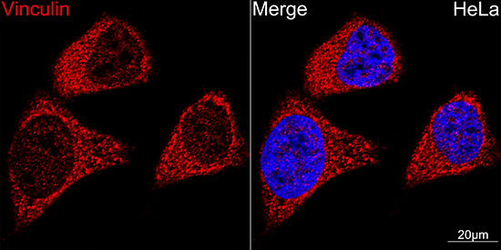 Vinculin Rabbit monoclonal antibody