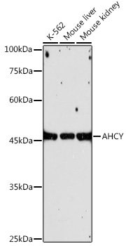 AHCY Rabbit monoclonal antibody