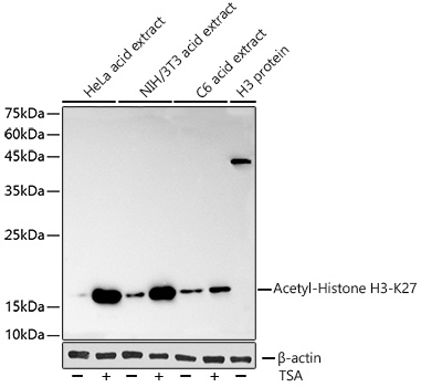Acetyl-Histone H3-K27 Rabbit monoclonal antibody