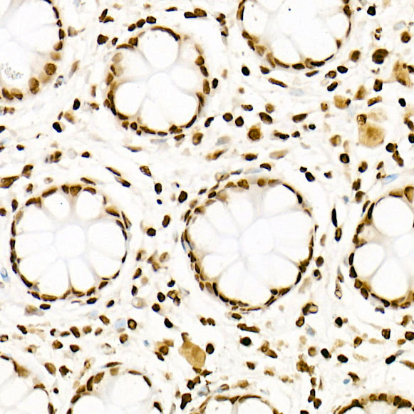 Acetyl-Histone H3-K27 Rabbit monoclonal antibody