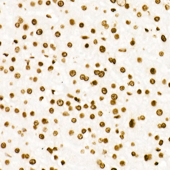 Acetyl-Histone H3-K27 Rabbit monoclonal antibody