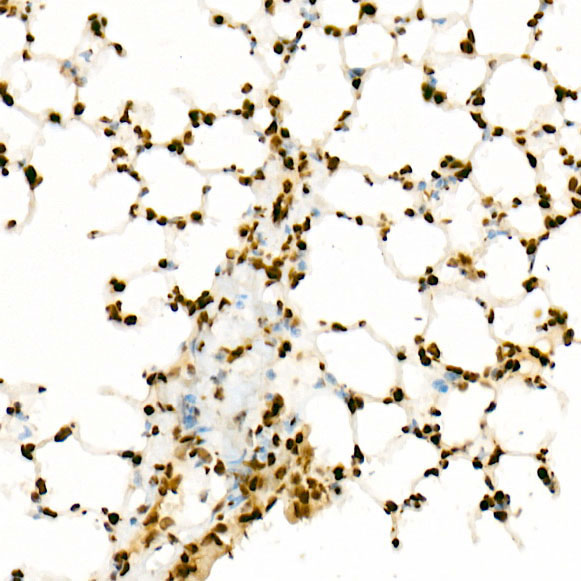 Acetyl-Histone H3-K27 Rabbit monoclonal antibody