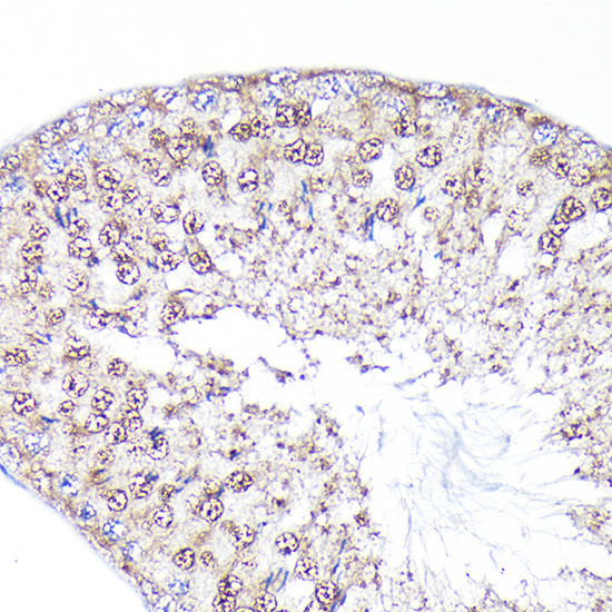 PEG10 Rabbit polyclonal antibody