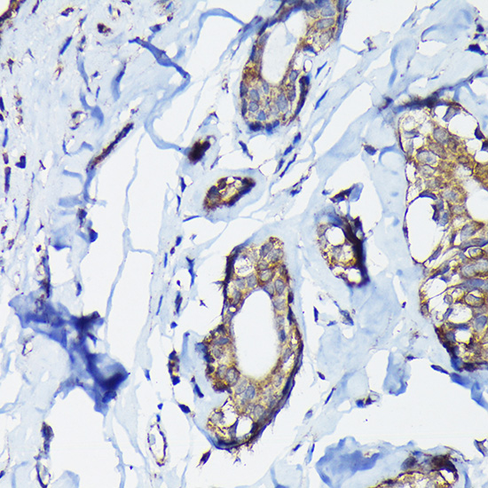 PEG10 Rabbit polyclonal antibody